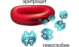 Талассемия: понятие, развитие и формы, течение, терапия