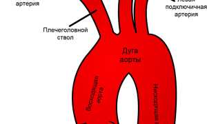 Брахиоцефальные артерии (БЦА): роль, анатомия, патология и методы её диагностики