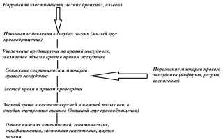 Правожелудочковая недостаточность: причины, симптомы, формы, диагностика, лечение