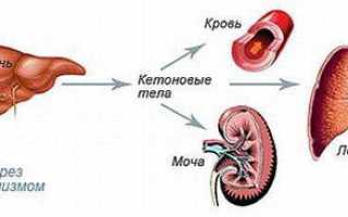 Ацетон в крови: почему появляется, признаки и формы повышения, диагностика, терапия