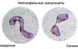 Нейтрофилы:  роль, виды (палочкоядерные, сегментоядерные), повышенные и пониженные, у взрослых и детей