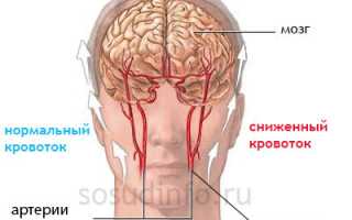 Стенозы (артерий и клапанов сердца): локализации, специфика, лечение