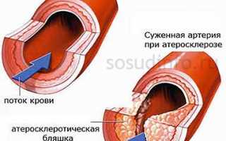 Витамины для укрепления сосудов: какие нужны и где их искать?
