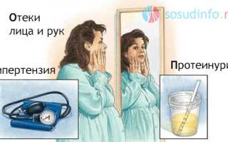 Гестоз: понятие, как проявляется, степени и их клиника, чем опасен, диагностика, лечение