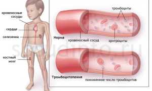 Тромбоциты: норма и патология, механизмы гемостаза и свертывания крови, лечение нарушений