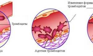 Агрегация тромбоцитов: понятие, в анализе крови, отклонения от нормы, нюансы