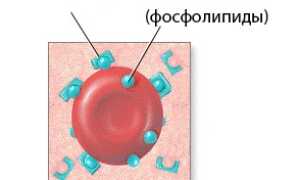 Антифосфолипидный синдром (АФС): суть, развитие, причины, диагностика, лечение, чем опасен