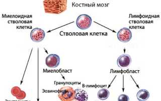 Миелодиспластический синдром: классификация, развитие, лечение, рекомендации, прогноз