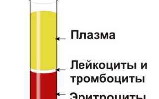 Тромбокрит: что это, норма и отклонения, причины высокого и низкого