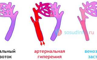 Гиперемия (полнокровие): причины, когда это болезнь, локализации, лечение