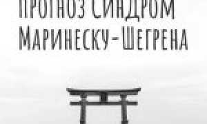 Синдром Шегрена: что это за болезнь, причины, симптомы, лечение и профилактика