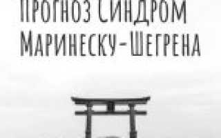 Синдром Шегрена: что это за болезнь, причины, симптомы, лечение и профилактика