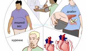 Профилактика инсульта: риски и с чем бороться, образ жизни, оздоравливающие средства