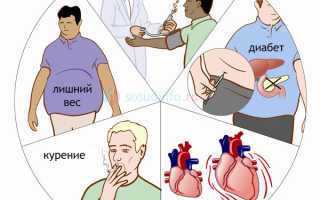 Профилактика инсульта: риски и с чем бороться, образ жизни, оздоравливающие средства