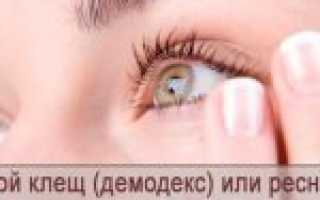Ресничный клещ или глазной клещ (демодекс): симптомы и лечение