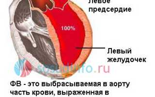 Фракция выброса левого желудочка сердца: нормы, причины понижения и высокой, как повысить