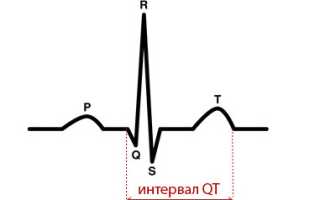 Интервал QT: понятие, норма, синдром удлиненного – его диагностика и лечение