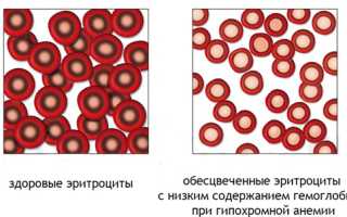Цветовой показатель: расчет, норма у детей и взрослых, причины низкого и высокого