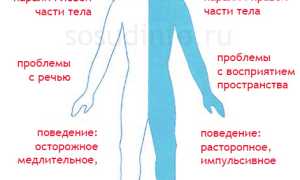 Транзиторная ишемическая атака: причины, признаки, диагностика, терапия, прогноз
