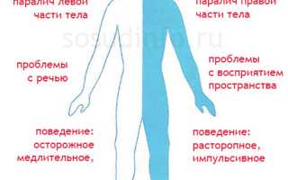 Транзиторная ишемическая атака: причины, признаки, диагностика, терапия, прогноз