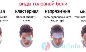 Цервикокраниалгия: суть и правомерность диагноза, причины, симптоматика, тактика лечения