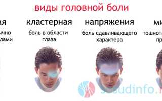 Цервикокраниалгия: суть и правомерность диагноза, причины, симптоматика, тактика лечения