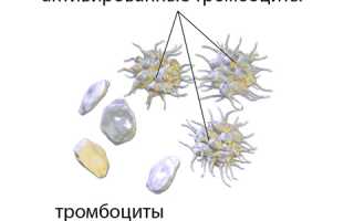 Средний объем тромбоцитов (MPV): что это, норма в анализе крови, повышение и понижение