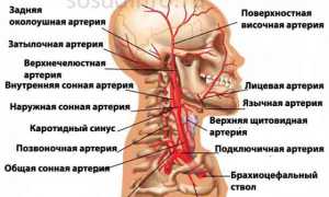 Атеросклероз сосудов головы: его причины, симптомы и лечение