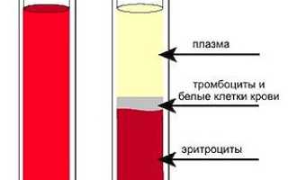 Плазма крови: составные элементы (вещества, белки), функции в организме, использование