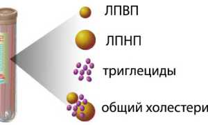 Липидограмма: суть анализа, что показывает, норма и отклонения, как сдавать