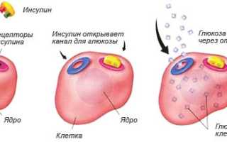 Кетоацидоз: понятие, развитие при сахарном диабете, признаки, как лечить, прогноз