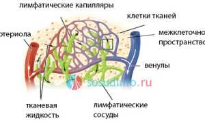 Лимфостаз (лимфедема) ног и рук: причины и развитие, формы, симптомы, как лечить