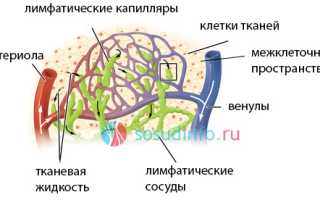 Лимфостаз (лимфедема) ног и рук: причины и развитие, формы, симптомы, как лечить