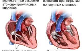 Ритм галопа и ритм перепела: признаки патологических тонов, причины, диагностика, лечение