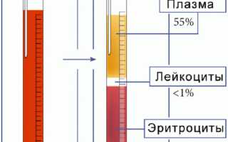 РОЭ (реакция оседания эритроцитов): суть, нормы в анализе, методы исследования, отклонения уровня
