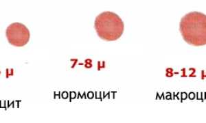 Ширина распределения эритроцитов (индекс RDW): что это, норма, повышен и понижен