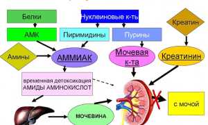 Уремия: понятие, почему и как развивается, клиника и проявления, диагностика, терапия