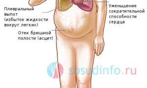 Опухают ноги: причины, связь с болезнями и норма, как лечить, когда опасно