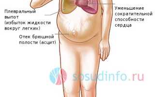 Опухают ноги: причины, связь с болезнями и норма, как лечить, когда опасно