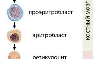 Нормохромная анемия: диагноз, причины развития, клиника, принципы терапии, прогнозы