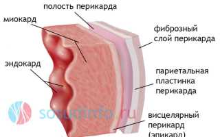 Миокардиодистрофия: что это, как развивается, обзор различных видов