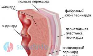 Ревмокардит: механизм развития, признаки и проявления, диагностика, лечение, прогноз