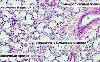 Воспаление слюнных желез: причины, симптомы и лечение