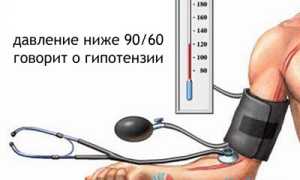Гипотония (низкое давление): признаки, причины возникновения, нейтрализация патологии