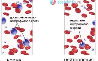 Повышенные лимфоциты в крови при пониженных нейтрофилах: обзор и сопоставление причин