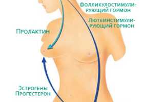 Маточные кровотечения: причины и признаки, разбор исходя из возраста, лечение