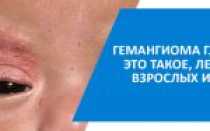 Гемангиома глаза у новорожденных детей: лечение и диагностика