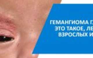 Гемангиома глаза у новорожденных детей: лечение и диагностика