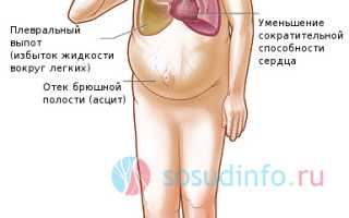 Одышка: сердечная и другие виды – почему появляется, как избавиться и вылечить