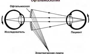 Желтые пятна перед глазами – опасно ли это и почему они появляются
